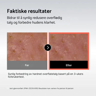 CELLADIX Sebum Rebalancing RX 131 Ampoule - K - Town Norway