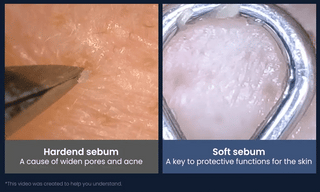 CELLADIX Sebum Rebalancing RX 131 Ampoule - K - Town Norway