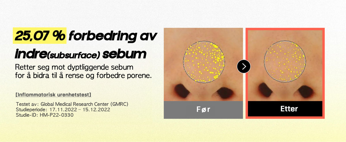 Surface Sebum