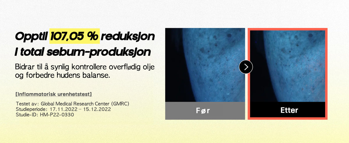 Inner Sebum