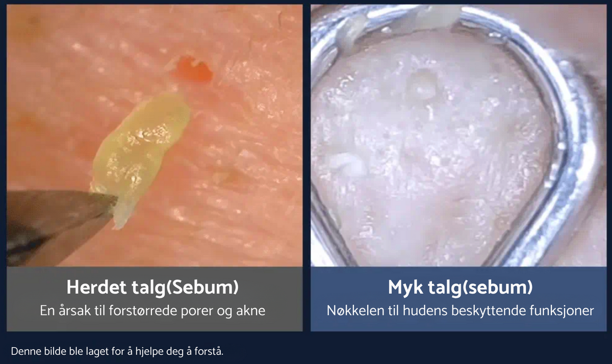 Forbedrer herdet talg